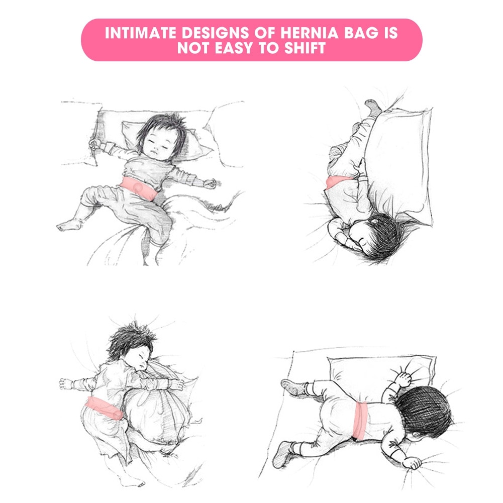 2pcs Umbilical Hernia Therapy Treatment Belt Breathable Bag Elastic Cotton Strap for 0-1 Years Old Baby Children Infant Kids